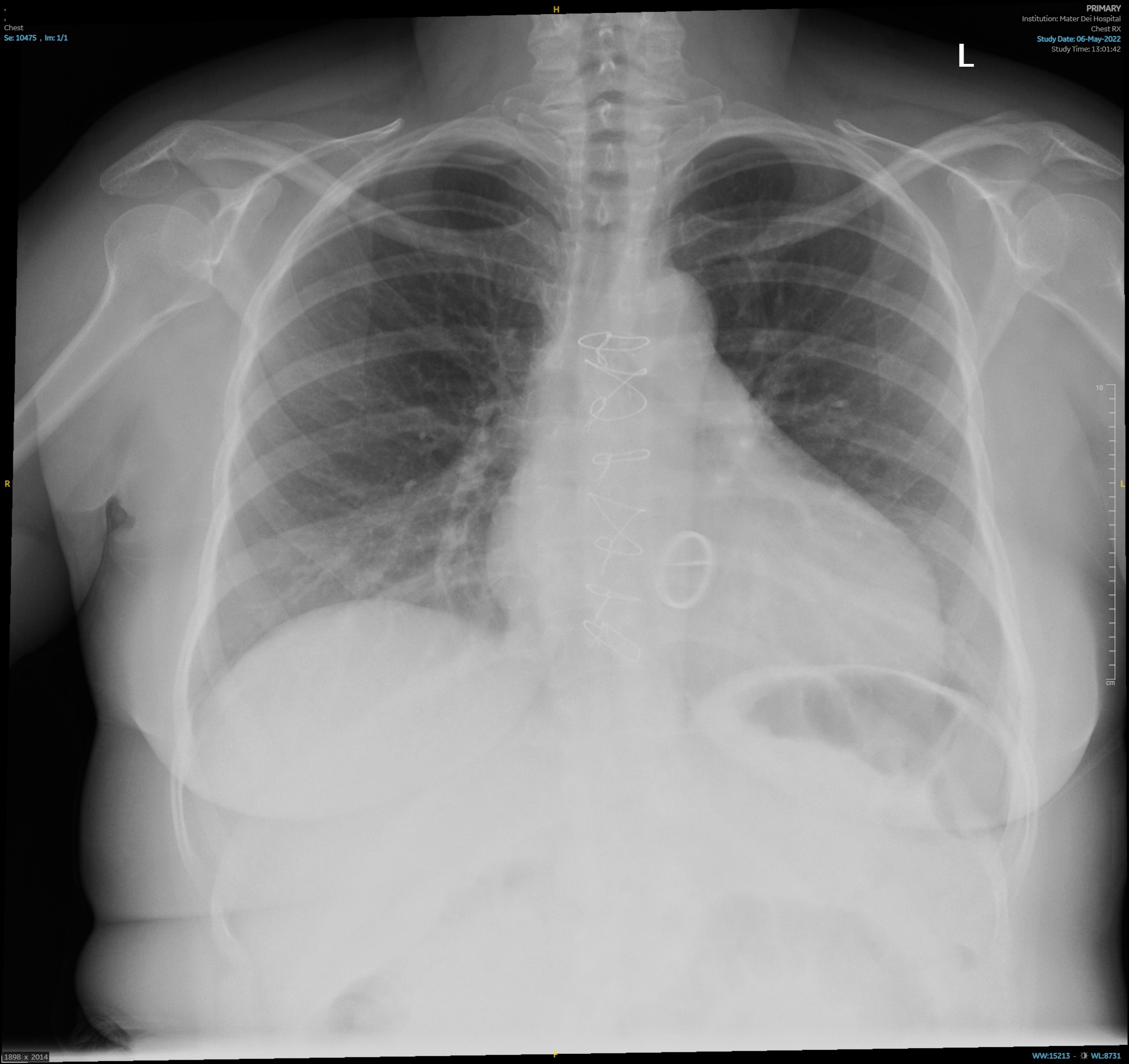 Figure 5
