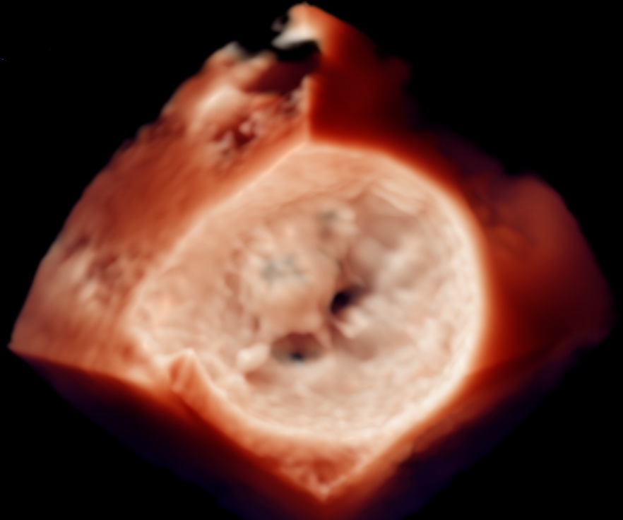 Figure 6